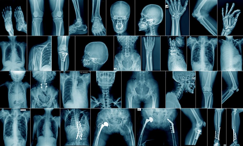 Medical X Ray Images